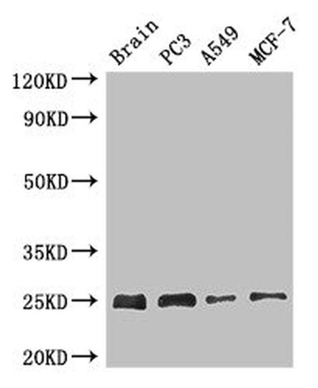 APOPT1 Antibody in Western Blot (WB)