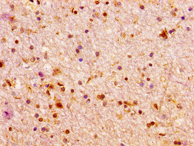 ARX Antibody in Immunohistochemistry (Paraffin) (IHC (P))