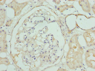 CLYBL Antibody in Immunohistochemistry (Paraffin) (IHC (P))