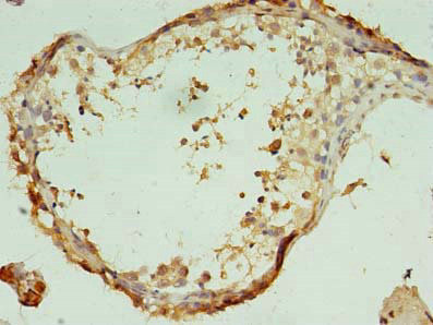 C7orf62 Antibody in Immunohistochemistry (Paraffin) (IHC (P))