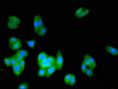 ACMSD Antibody in Immunocytochemistry (ICC/IF)