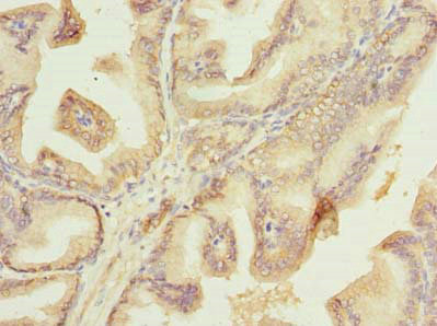 Plet1 Antibody in Immunohistochemistry (Paraffin) (IHC (P))