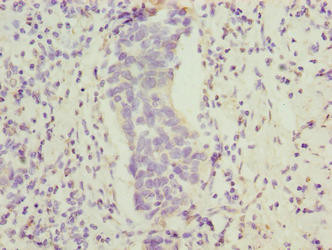 FAM222B Antibody in Immunohistochemistry (Paraffin) (IHC (P))