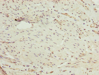PPIL4 Antibody in Immunohistochemistry (Paraffin) (IHC (P))
