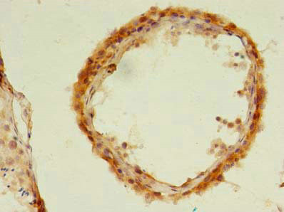 UBLCP1 Antibody in Immunohistochemistry (Paraffin) (IHC (P))