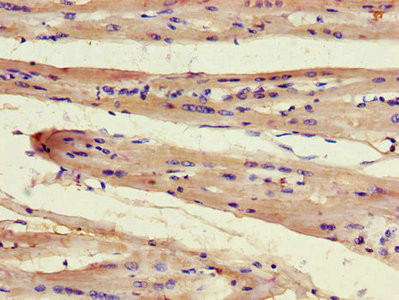 FAM43A Antibody in Immunohistochemistry (Paraffin) (IHC (P))