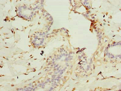 CEP76 Antibody in Immunohistochemistry (Paraffin) (IHC (P))