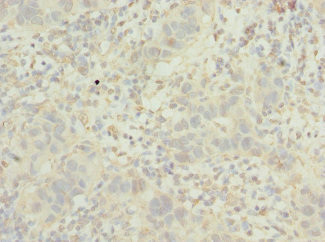 POC1B Antibody in Immunohistochemistry (Paraffin) (IHC (P))