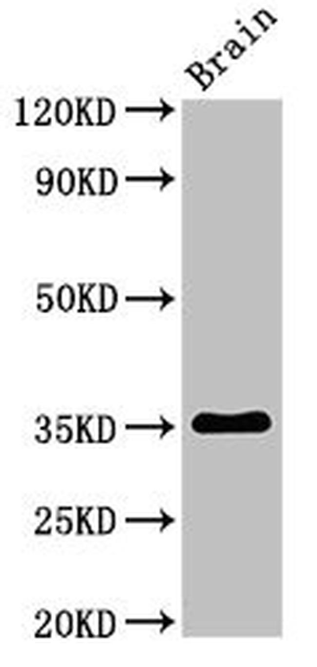 METRNL Antibody in Western Blot (WB)