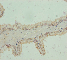 RNF34 Antibody in Immunohistochemistry (Paraffin) (IHC (P))