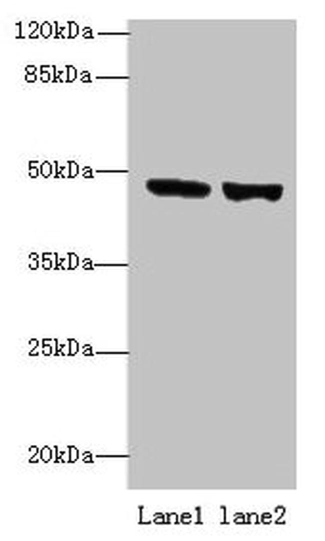 FAM46B Antibody in Western Blot (WB)