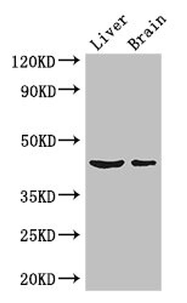 METTL2 Antibody in Western Blot (WB)