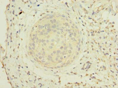 ZHX1 Antibody in Immunohistochemistry (Paraffin) (IHC (P))