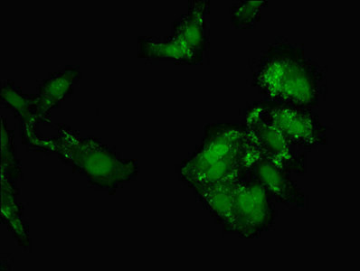 CT112 Antibody in Immunocytochemistry (ICC/IF)