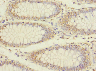 Erbin Antibody in Immunohistochemistry (Paraffin) (IHC (P))