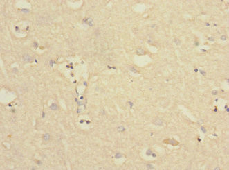 PTPN18 Antibody in Immunohistochemistry (Paraffin) (IHC (P))