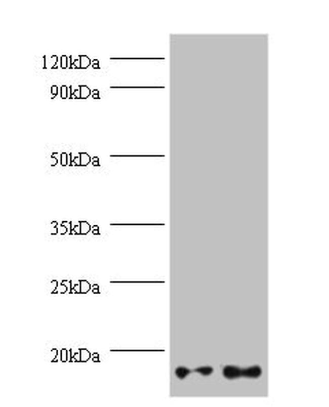 Gemin 7 Antibody in Western Blot (WB)