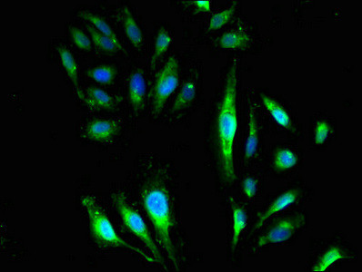 GNB4 Antibody in Immunocytochemistry (ICC/IF)