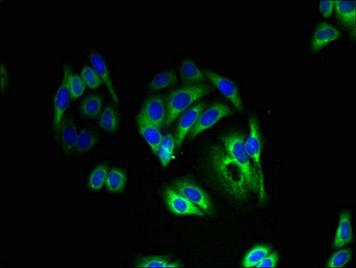 KCNK13 Antibody in Immunocytochemistry (ICC/IF)