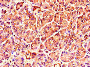 TNRC6C Antibody in Immunohistochemistry (Paraffin) (IHC (P))