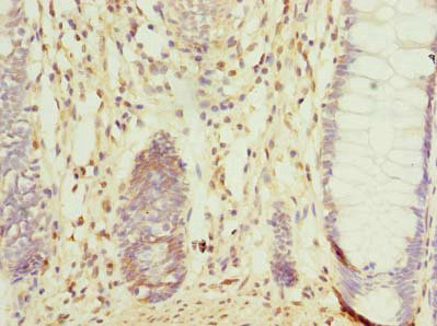 CCDC106 Antibody in Immunohistochemistry (Paraffin) (IHC (P))