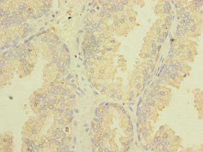 TSGA10 Antibody in Immunohistochemistry (Paraffin) (IHC (P))