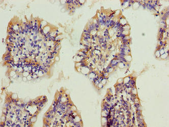 OSER1 Antibody in Immunohistochemistry (Paraffin) (IHC (P))