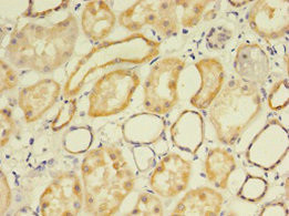 FLRT1 Antibody in Immunohistochemistry (Paraffin) (IHC (P))
