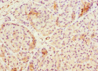 Tug Antibody in Immunohistochemistry (Paraffin) (IHC (P))