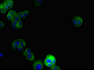 DRAM2 Antibody in Immunocytochemistry (ICC/IF)