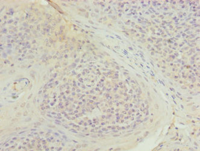 TUBB1 Antibody in Immunohistochemistry (Paraffin) (IHC (P))