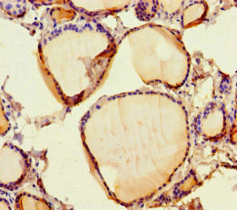 RISC Antibody in Immunohistochemistry (Paraffin) (IHC (P))