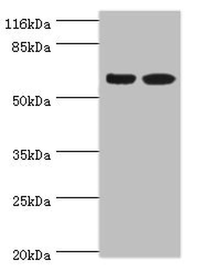 SPATS2L Antibody in Western Blot (WB)