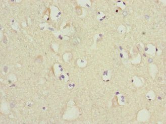 MTCH1 Antibody in Immunohistochemistry (Paraffin) (IHC (P))