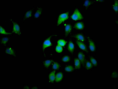 CLIP2 Antibody in Immunocytochemistry (ICC/IF)