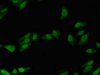 POLL Antibody in Immunocytochemistry (ICC/IF)