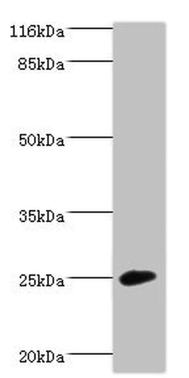 CaBP8 Antibody in Western Blot (WB)