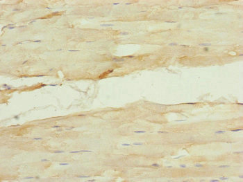 NUF2 Antibody in Immunohistochemistry (Paraffin) (IHC (P))
