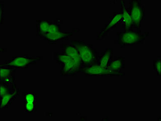 CSN7b Antibody in Immunocytochemistry (ICC/IF)