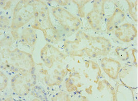 TMOD3 Antibody in Immunohistochemistry (Paraffin) (IHC (P))