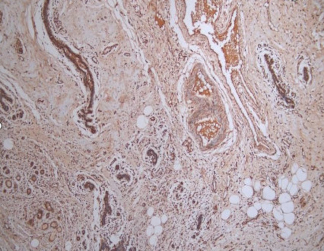 MCAR1 Antibody in Immunohistochemistry (Paraffin) (IHC (P))