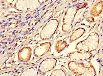 SMOC1 Antibody in Immunohistochemistry (Paraffin) (IHC (P))