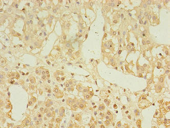 C2orf43 Antibody in Immunohistochemistry (Paraffin) (IHC (P))