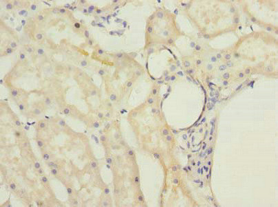 MRPL22 Antibody in Immunohistochemistry (Paraffin) (IHC (P))