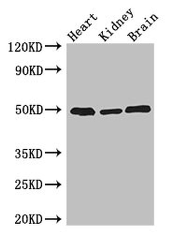 ANKRD10 Antibody in Western Blot (WB)