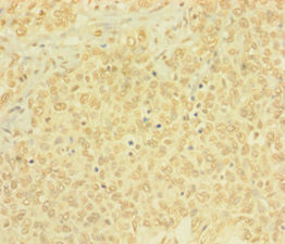 BTG4 Antibody in Immunohistochemistry (Paraffin) (IHC (P))