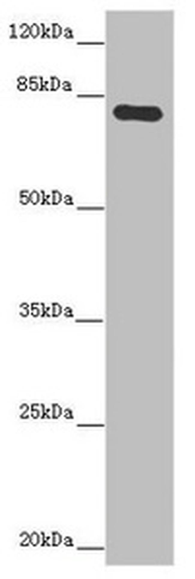MOCS1 Antibody in Western Blot (WB)