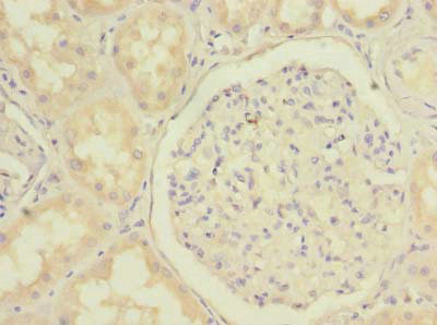 C20orf72 Antibody in Immunohistochemistry (Paraffin) (IHC (P))
