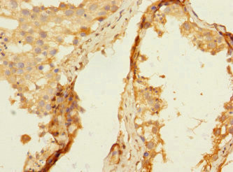 NTM Antibody in Immunohistochemistry (Paraffin) (IHC (P))