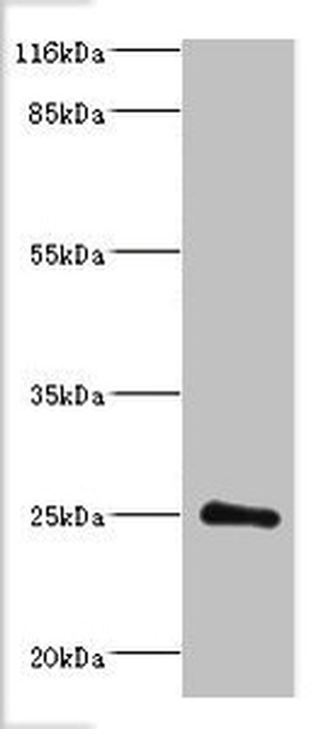 DGCR6L Antibody in Western Blot (WB)